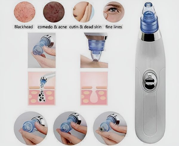 Derma Suction Blackhead Remover - Vacuum Pore Cleaner (Cell Operated)